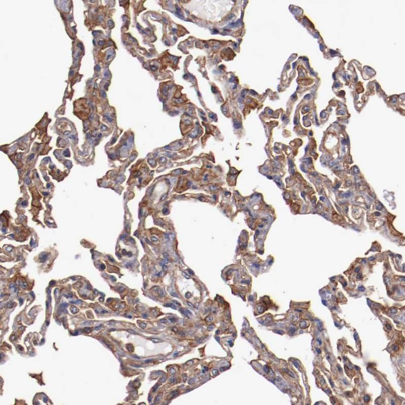 Tropomodulin 3 Antibody - BSA Free Immunohistochemistry-Paraffin: Tropomodulin 3 Antibody - BSA Free [NBP1-86870]