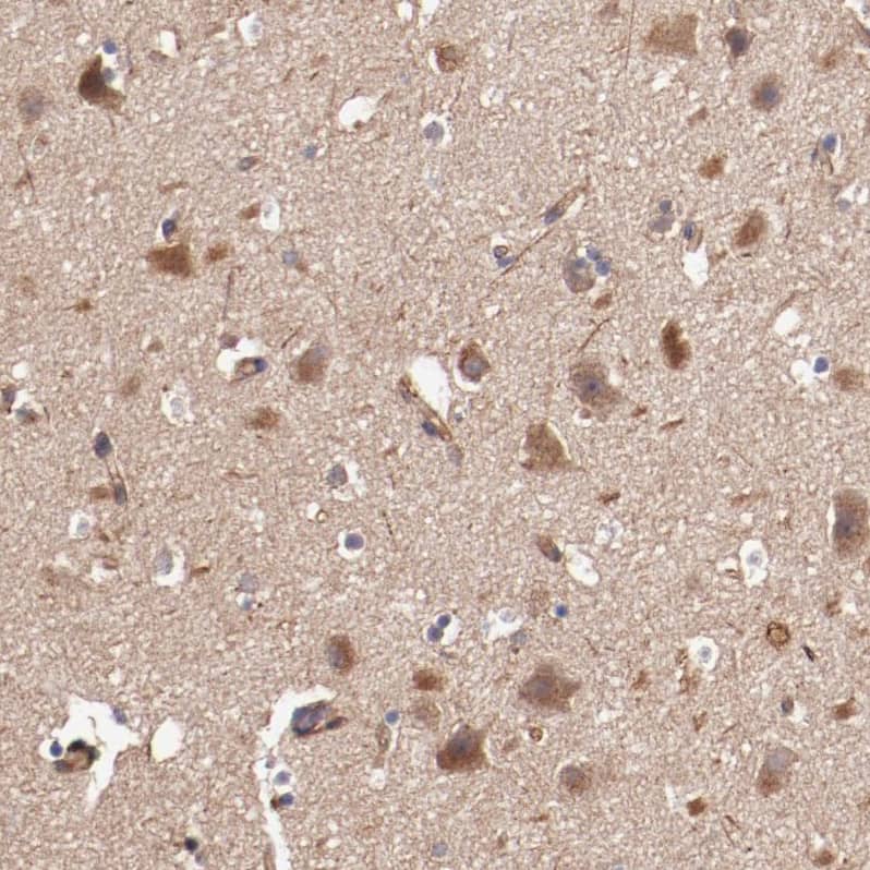 Tropomodulin 3 Antibody - BSA Free Immunohistochemistry-Paraffin: Tropomodulin 3 Antibody - BSA Free [NBP1-86870]