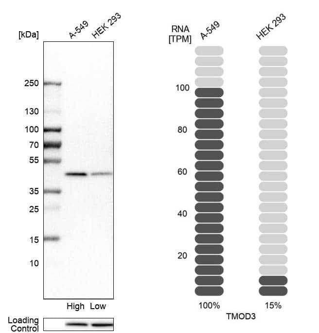 Tropomodulin 3 Antibody - BSA Free Western Blot: Tropomodulin 3 Antibody - BSA Free [NBP1-86870]