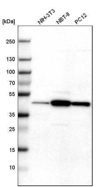 Tropomodulin 3 Antibody - BSA Free Western Blot: Tropomodulin 3 Antibody - BSA Free [NBP1-86870]