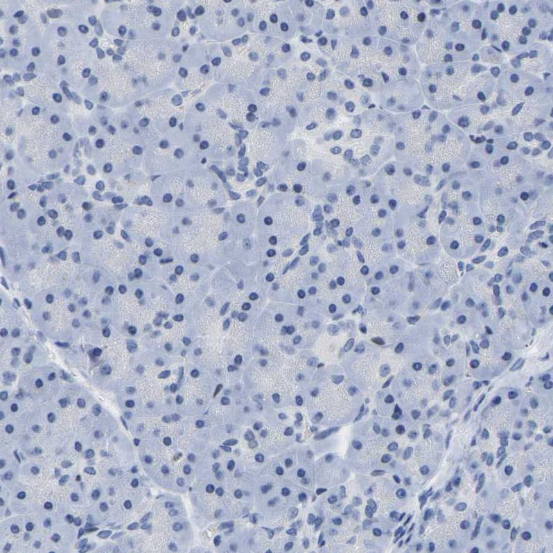 Uroplakin III Antibody - BSA Free Immunohistochemistry-Paraffin: Uroplakin III Antibody - BSA Free [NBP1-86873]