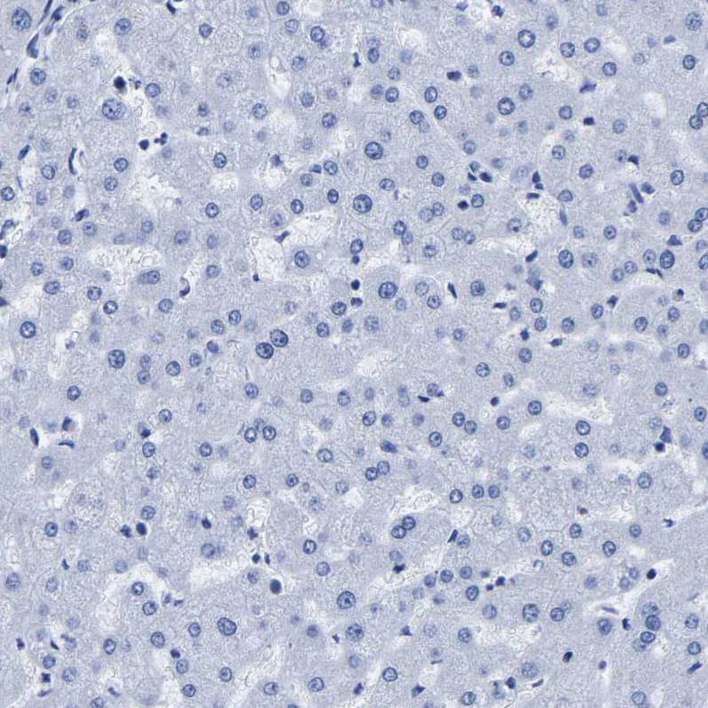 Uroplakin III Antibody - BSA Free Immunohistochemistry-Paraffin: Uroplakin III Antibody - BSA Free [NBP1-86873]