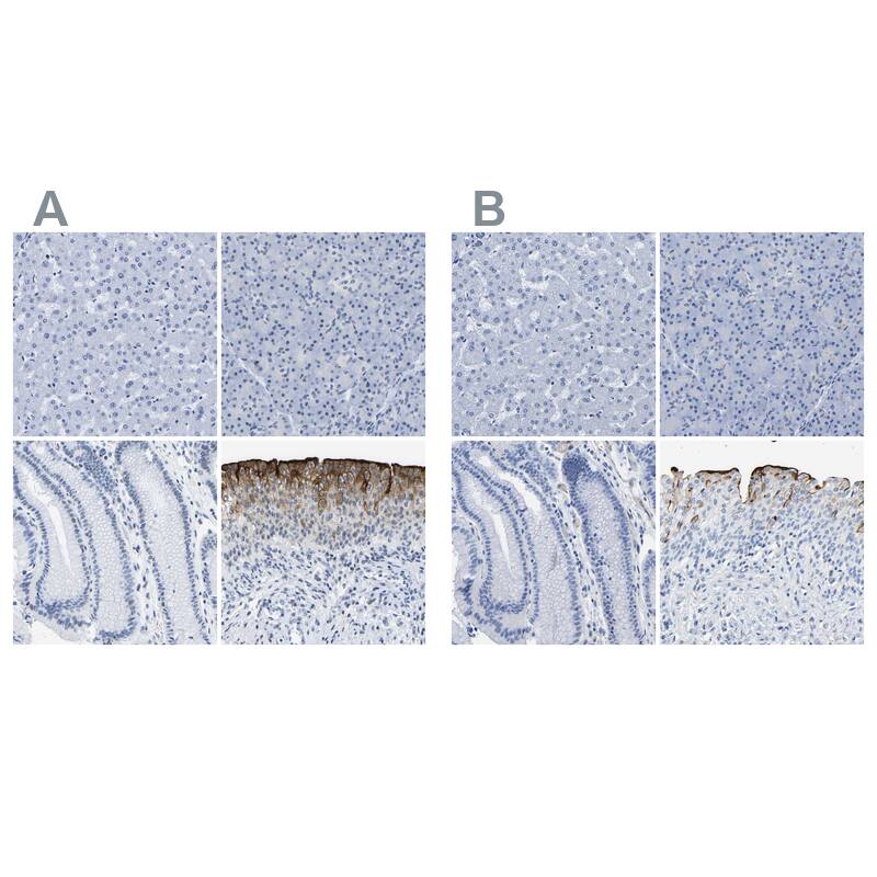 Uroplakin III Antibody - BSA Free Immunohistochemistry-Paraffin: Uroplakin III Antibody - BSA Free [NBP1-86873]