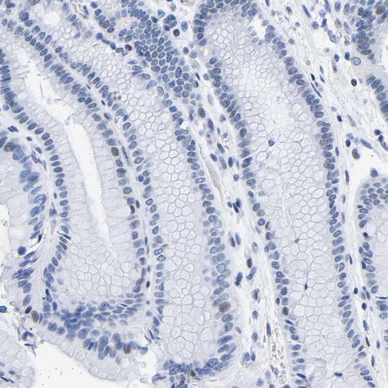 Uroplakin III Antibody - BSA Free Immunohistochemistry-Paraffin: Uroplakin III Antibody - BSA Free [NBP1-86873]