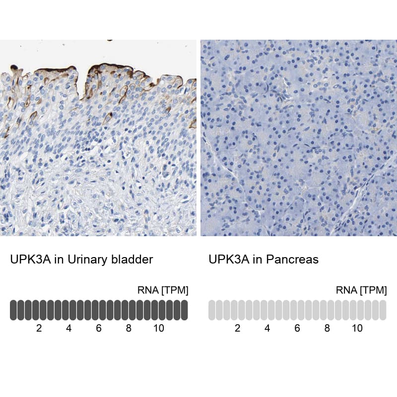 Uroplakin III Antibody - BSA Free Immunohistochemistry-Paraffin: Uroplakin III Antibody - BSA Free [NBP1-86874]