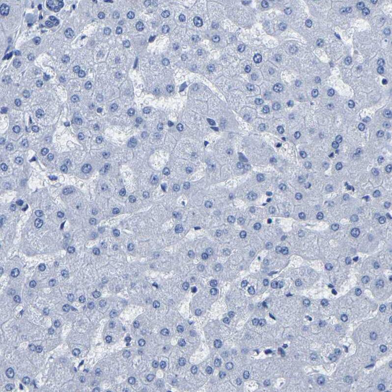Uroplakin III Antibody - BSA Free Immunohistochemistry-Paraffin: Uroplakin III Antibody - BSA Free [NBP1-86874]