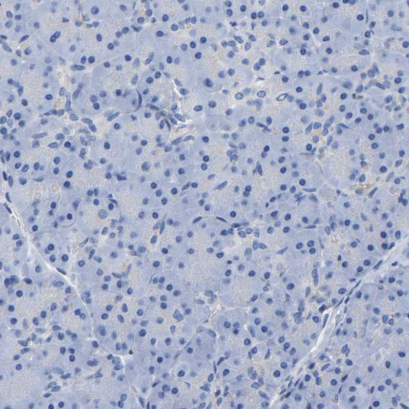 Uroplakin III Antibody - BSA Free Immunohistochemistry-Paraffin: Uroplakin III Antibody - BSA Free [NBP1-86874]