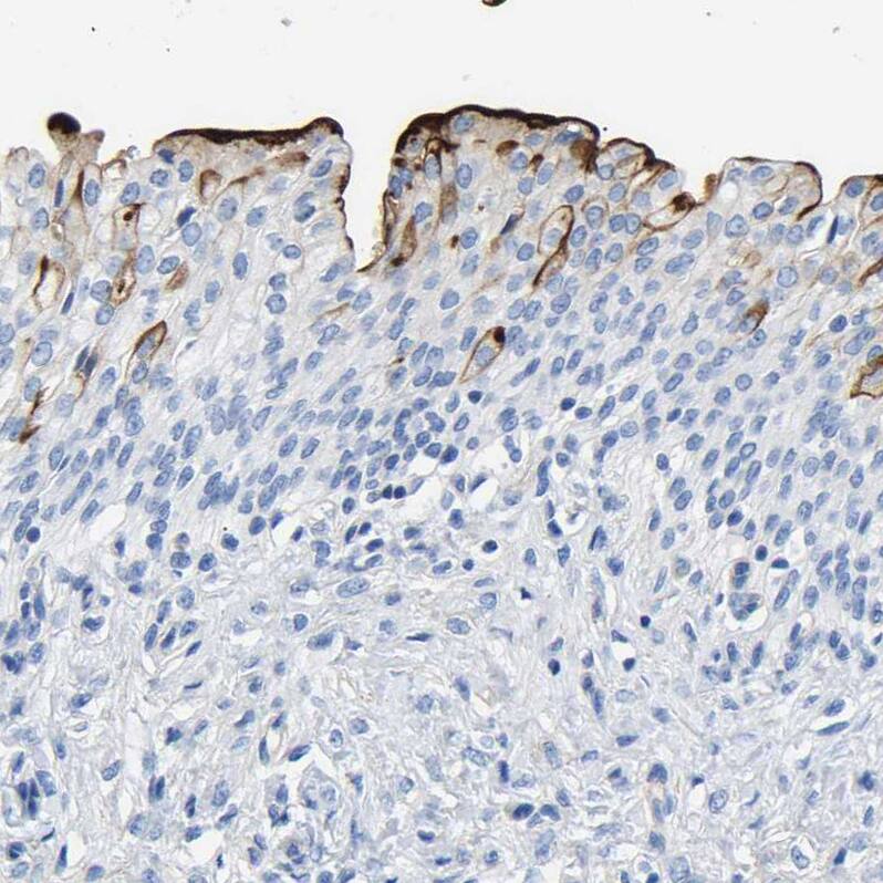 Uroplakin III Antibody - BSA Free Immunohistochemistry-Paraffin: Uroplakin III Antibody - BSA Free [NBP1-86874]