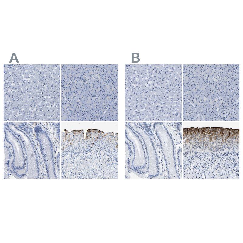 Uroplakin III Antibody - BSA Free Immunohistochemistry-Paraffin: Uroplakin III Antibody - BSA Free [NBP1-86874]