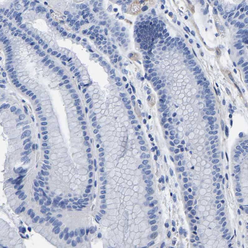 Uroplakin III Antibody - BSA Free Immunohistochemistry-Paraffin: Uroplakin III Antibody - BSA Free [NBP1-86874]