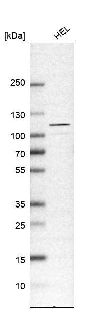 USP4 Antibody - BSA Free Western Blot: USP4 Antibody - BSA Free [NBP1-86876]