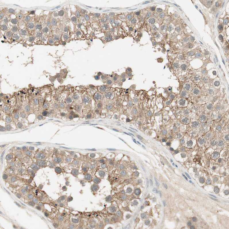 USP2 Antibody - BSA Free Immunohistochemistry-Paraffin: USP2 Antibody [NBP1-86882]