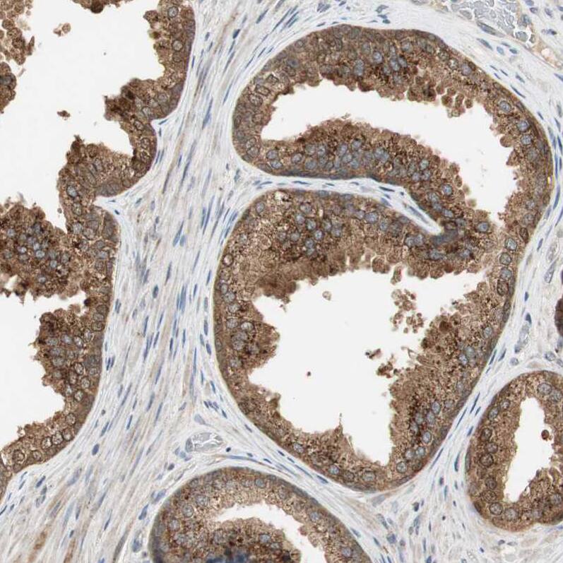 USP2 Antibody - BSA Free Immunohistochemistry-Paraffin: USP2 Antibody [NBP1-86882]