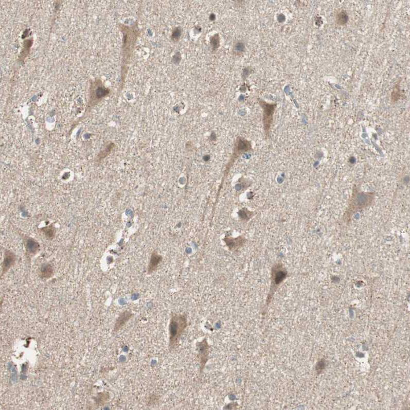 USP2 Antibody - BSA Free Immunohistochemistry-Paraffin: USP2 Antibody [NBP1-86882]