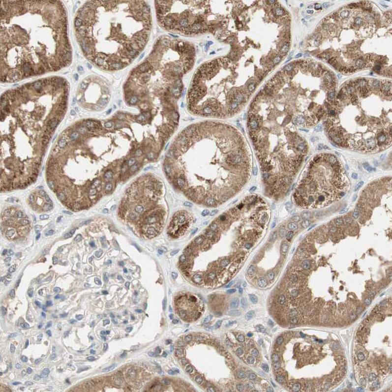 USP2 Antibody - BSA Free Immunohistochemistry-Paraffin: USP2 Antibody [NBP1-86882]