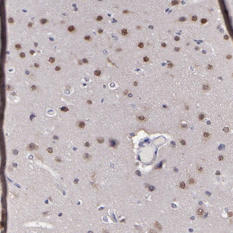 UBE2E3 Antibody - BSA Free Immunohistochemistry-Paraffin: UBE2E3 Antibody - BSA Free [NBP1-86884]