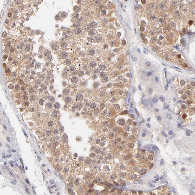 UBE2E3 Antibody - BSA Free Immunohistochemistry-Paraffin: UBE2E3 Antibody - BSA Free [NBP1-86884]