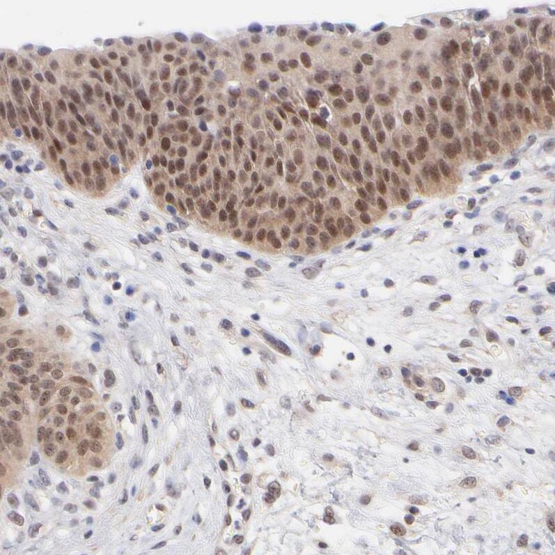 UBE2E3 Antibody - BSA Free Immunohistochemistry-Paraffin: UBE2E3 Antibody - BSA Free [NBP1-86884]
