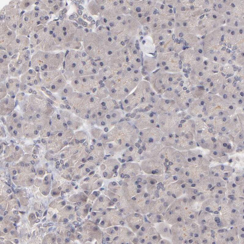 UBE2E3 Antibody - BSA Free Immunohistochemistry-Paraffin: UBE2E3 Antibody - BSA Free [NBP1-86884]