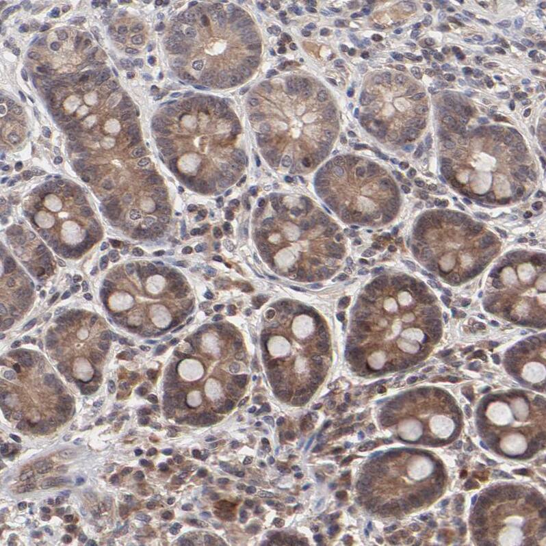 UbcH8/Ube2L6 Antibody - BSA Free Immunohistochemistry-Paraffin: UbcH8/Ube2L6 Antibody - BSA Free [NBP1-86885]