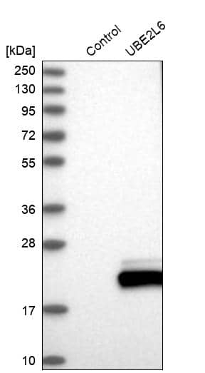 UbcH8/Ube2L6 Antibody - BSA Free Western Blot: UbcH8/Ube2L6 Antibody - BSA Free [NBP1-86885]
