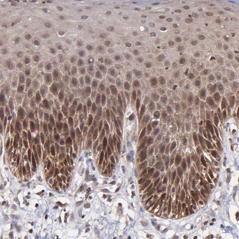 UbcH8/Ube2L6 Antibody - BSA Free Immunohistochemistry-Paraffin: UbcH8/Ube2L6 Antibody - BSA Free [NBP1-86885]
