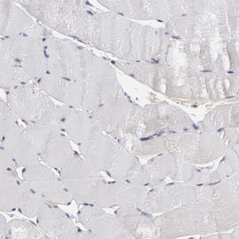 UbcH8/Ube2L6 Antibody - BSA Free Immunohistochemistry-Paraffin: UbcH8/Ube2L6 Antibody - BSA Free [NBP1-86885]