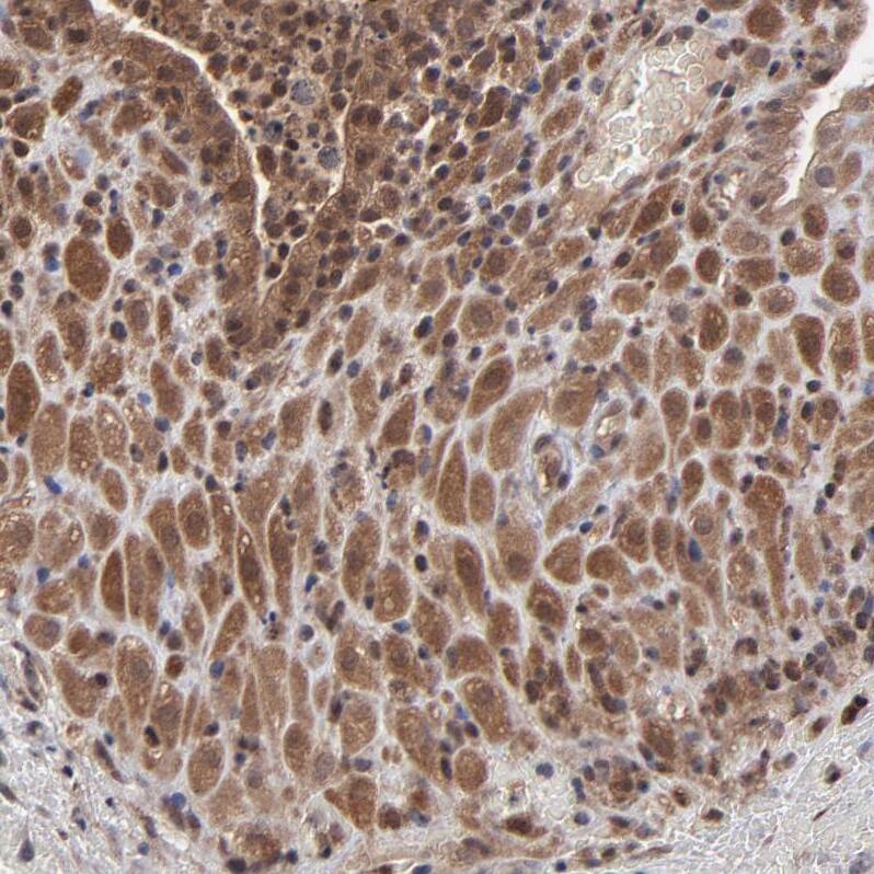 UbcH8/Ube2L6 Antibody - BSA Free Immunohistochemistry-Paraffin: UbcH8/Ube2L6 Antibody - BSA Free [NBP1-86885]