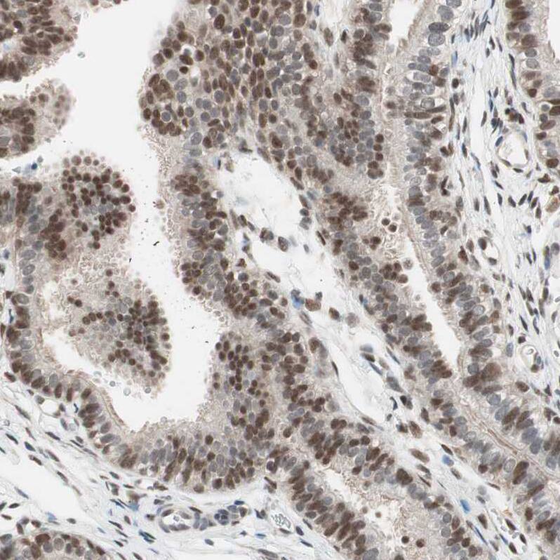 UBE2I/Ubc9 Antibody - BSA Free Immunohistochemistry-Paraffin: UBE2I/Ubc9 Antibody - BSA Free [NBP1-86887]