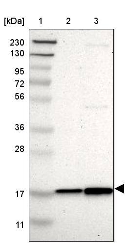 UBE2I/Ubc9 Antibody - BSA Free Western Blot: UBE2I/Ubc9 Antibody - BSA Free [NBP1-86887]
