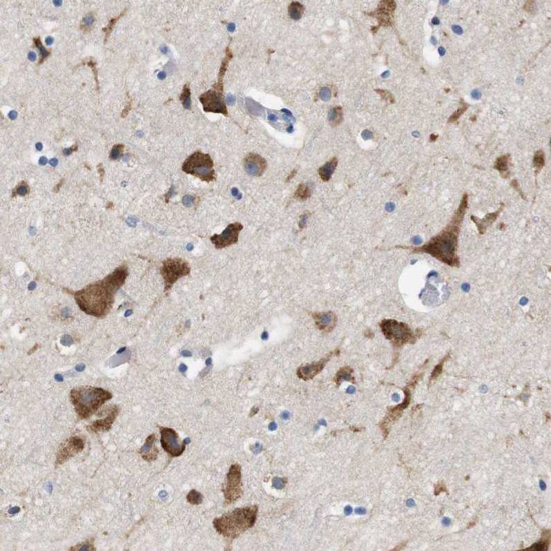 UBE2G2 Antibody - BSA Free Immunohistochemistry-Paraffin: UBE2G2 Antibody - BSA Free [NBP1-86888]