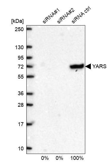 YARS Antibody - BSA Free Western Blot: YARS Antibody - BSA Free [NBP1-86889]