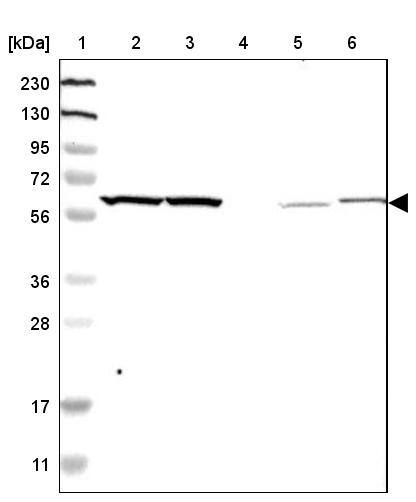 YARS Antibody - BSA Free Western Blot: YARS Antibody - BSA Free [NBP1-86890]