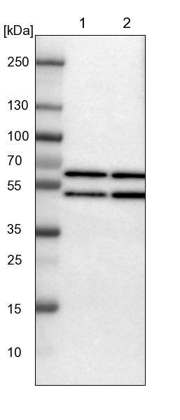 YARS Antibody - BSA Free Western Blot: YARS Antibody - BSA Free [NBP1-86890]