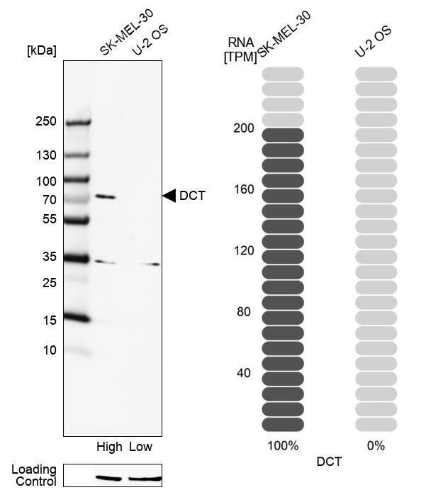 TRP2 Antibody - BSA Free Western Blot: TRP2 Antibody - BSA Free [NBP1-86892]