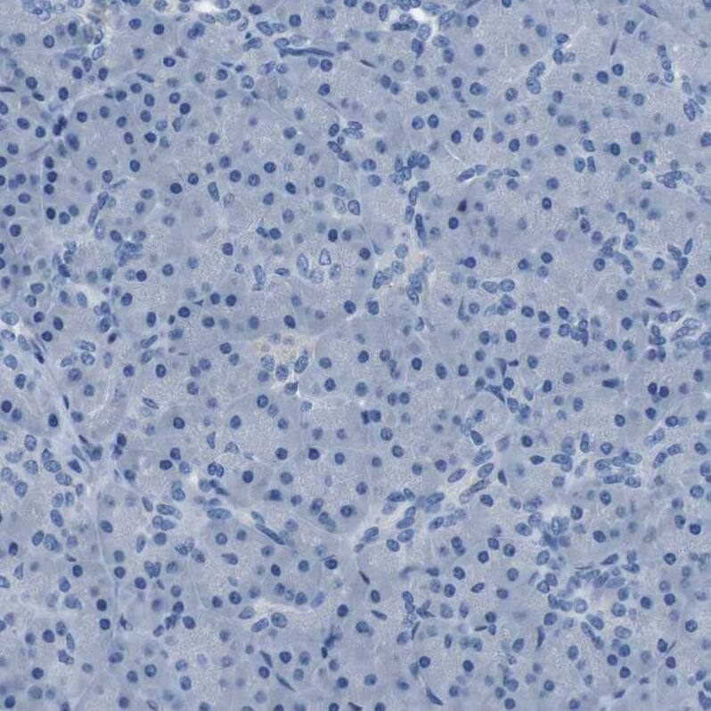 TULP3 Antibody - BSA Free Immunohistochemistry-Paraffin: TULP3 Antibody - BSA Free [NBP1-86897]