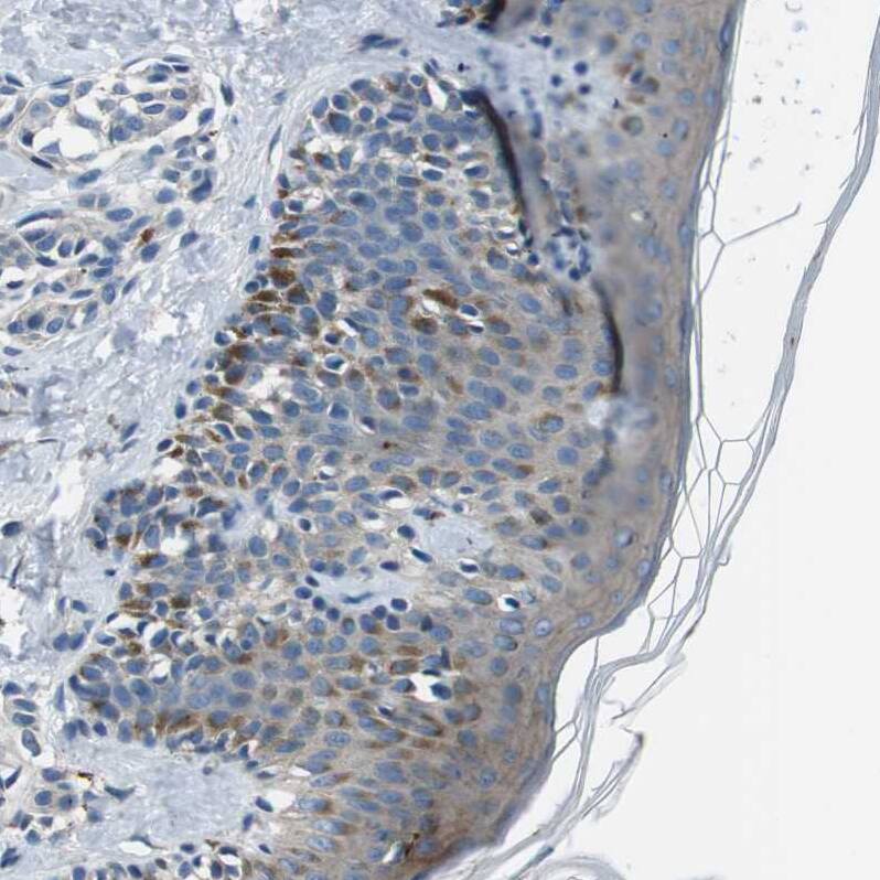 TULP3 Antibody - BSA Free Immunohistochemistry-Paraffin: TULP3 Antibody - BSA Free [NBP1-86897]