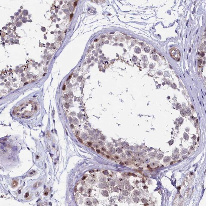 Treacher Collins syndrome protein Antibody - BSA Free Immunohistochemistry-Paraffin: Treacher Collins syndrome protein Antibody [NBP1-86908]