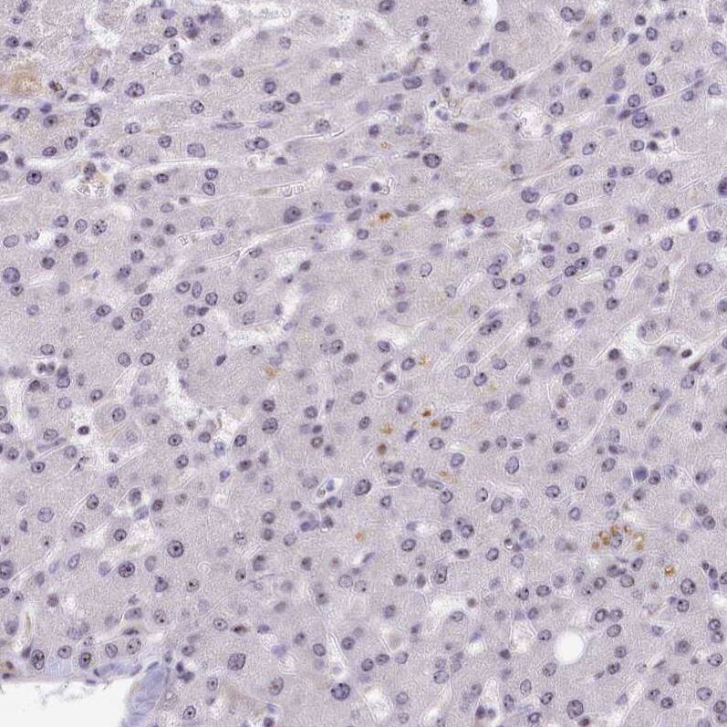 Treacher Collins syndrome protein Antibody - BSA Free Immunohistochemistry-Paraffin: Treacher Collins syndrome protein Antibody [NBP1-86908]