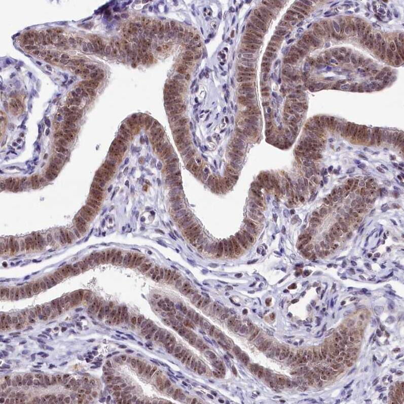Treacher Collins syndrome protein Antibody - BSA Free Immunohistochemistry-Paraffin: Treacher Collins syndrome protein Antibody [NBP1-86908]