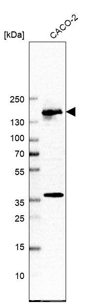 Treacher Collins syndrome protein Antibody - BSA Free Western Blot: Treacher Collins syndrome protein Antibody - BSA Free [NBP1-86908]