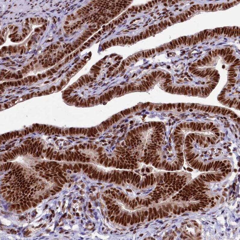 Treacher Collins syndrome protein Antibody - BSA Free Immunohistochemistry-Paraffin: Treacher Collins syndrome protein Antibody [NBP1-86909]