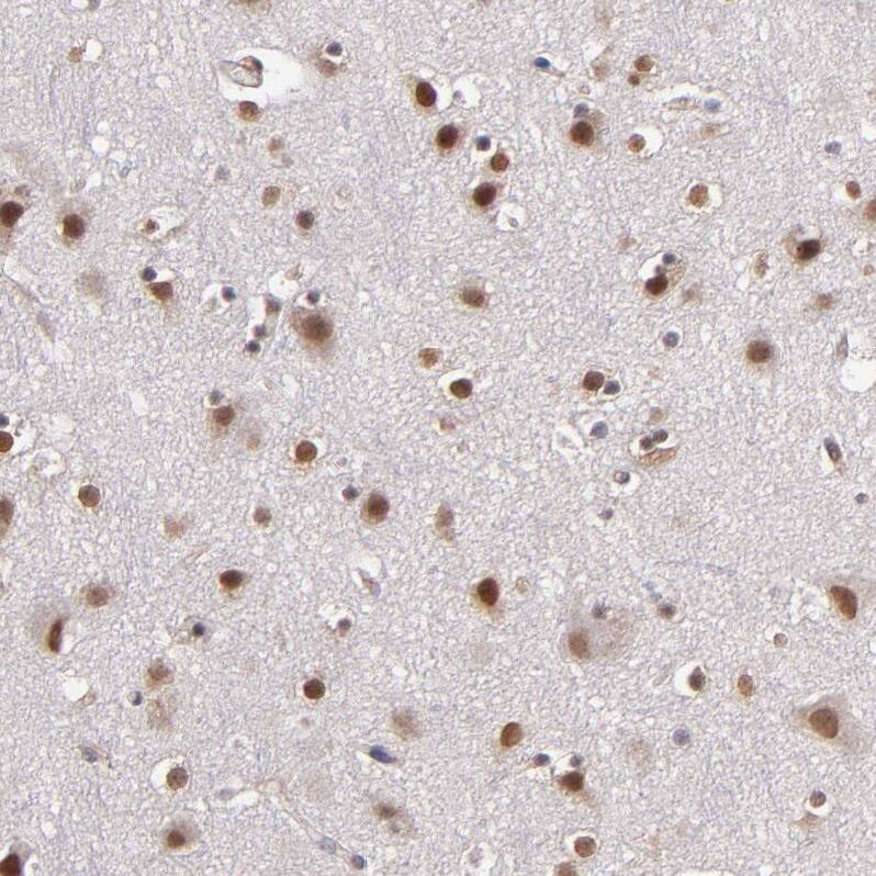 TRF-2 Antibody - BSA Free Immunohistochemistry-Paraffin: TRF-2 Antibody - BSA Free [NBP1-86910]