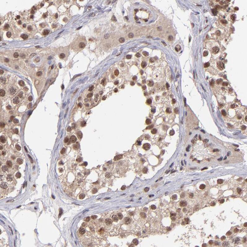 TRF-2 Antibody - BSA Free Immunohistochemistry-Paraffin: TRF-2 Antibody - BSA Free [NBP1-86910]