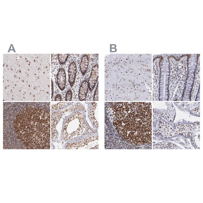 TRF-2 Antibody - BSA Free Immunohistochemistry-Paraffin: TRF-2 Antibody - BSA Free [NBP1-86910]