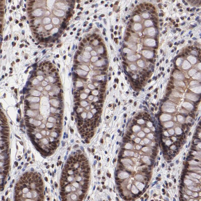 TRF-2 Antibody - BSA Free Immunohistochemistry-Paraffin: TRF-2 Antibody - BSA Free [NBP1-86910]