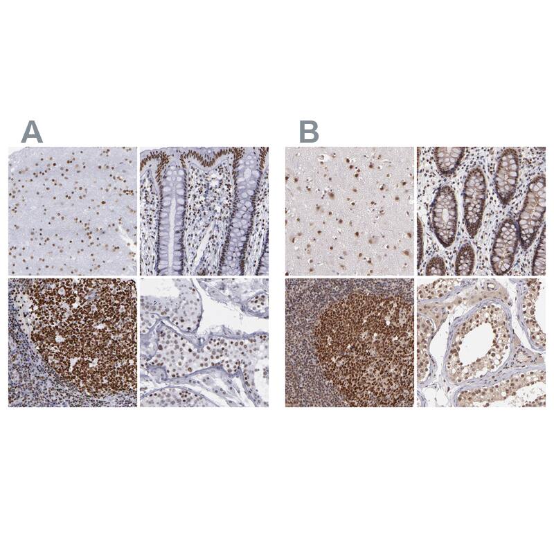 TRF-2 Antibody - BSA Free Immunohistochemistry-Paraffin: TRF-2 Antibody - BSA Free [NBP1-86911]