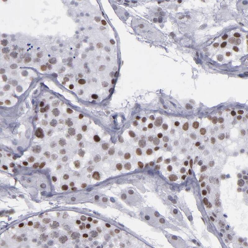 TRF-2 Antibody - BSA Free Immunohistochemistry-Paraffin: TRF-2 Antibody - BSA Free [NBP1-86911]