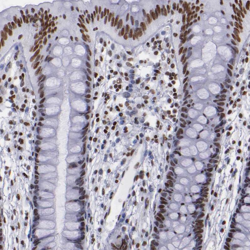 TRF-2 Antibody - BSA Free Immunohistochemistry-Paraffin: TRF-2 Antibody - BSA Free [NBP1-86911]