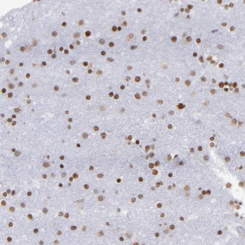TRF-2 Antibody - BSA Free Immunohistochemistry-Paraffin: TRF-2 Antibody - BSA Free [NBP1-86911]